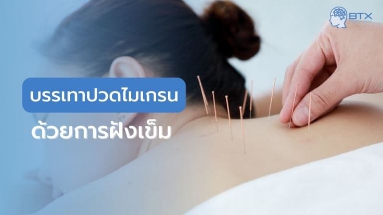 ฝังเข็มไมเกรน บรรเทาอาการปวดหัว รักษาไมเกรนโดยแพทย์แผนจีน