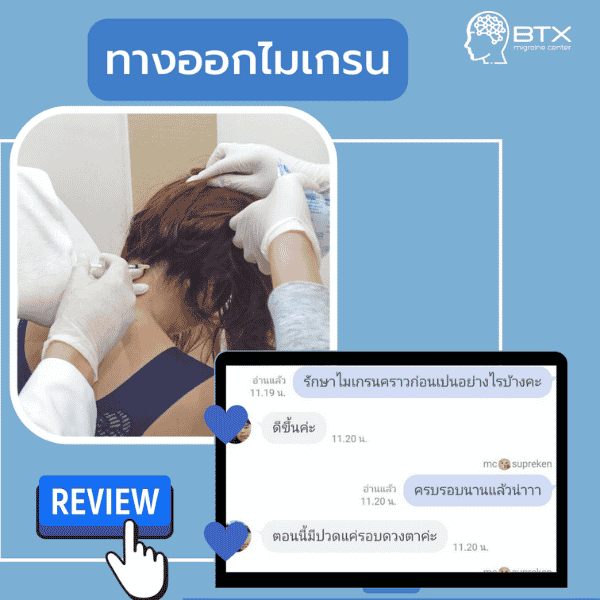 รีวิวรักษาไมเกรน