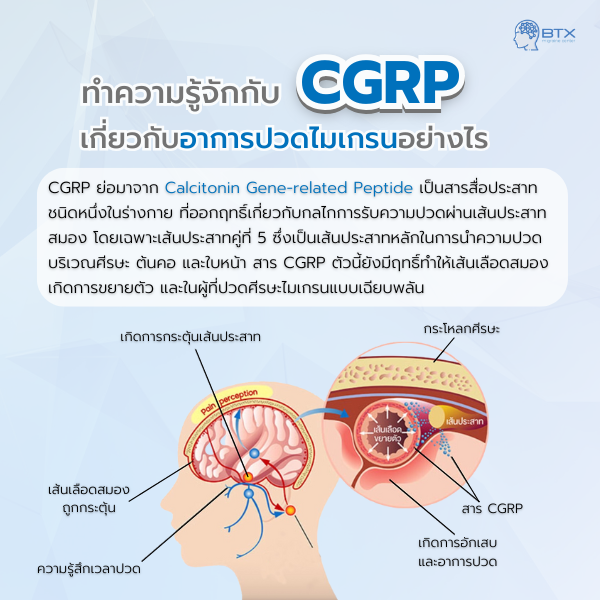 CGRP รู้จักยากลุ่มป้องกันรักษาไมเกรนแบบใหม่