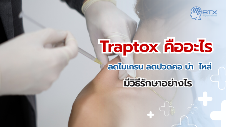 Traptox คืออะไร ช่วยลดปวดคอ บ่า ไหล่ และไมเกรนได้จริงหรือ ?